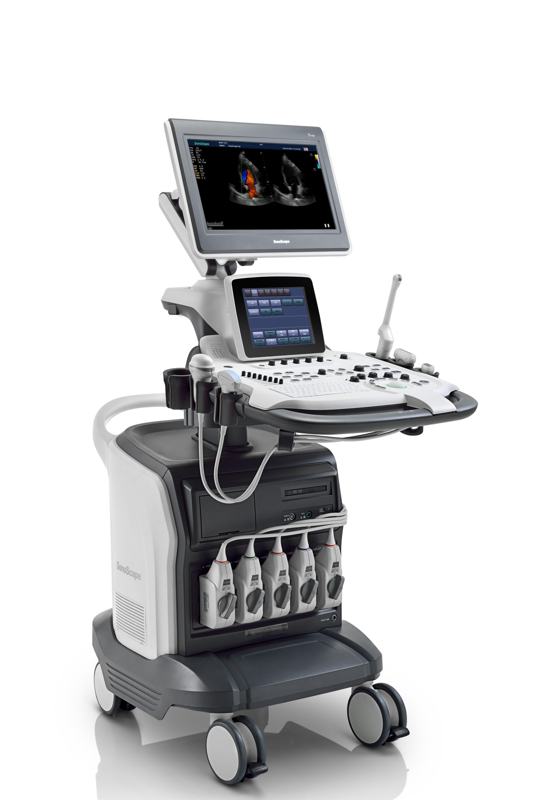 Ecógrafo Sonoscape S40